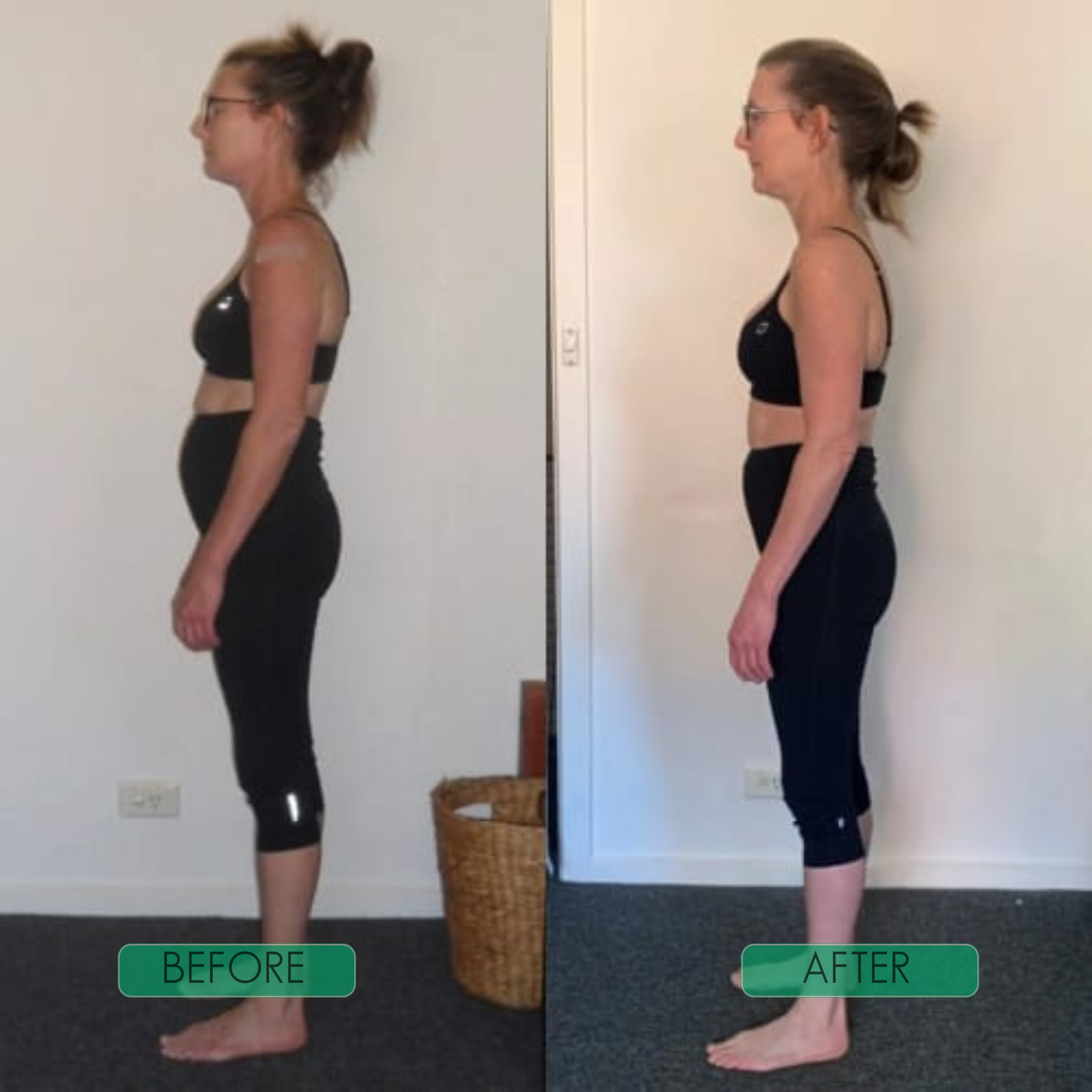 Posture Corrector Brace for Back and Shoulder Support