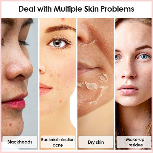 50% OFF | GlowPure™ - Gentle Facial Cleanser Device for Radiant Skin