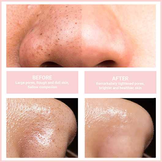 50% OFF | GlowPure™ - Gentle Facial Cleanser Device for Radiant Skin